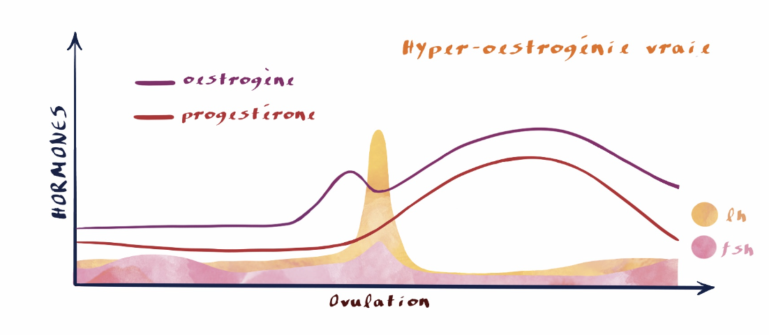 Courbe hormonale hyper-oestrogénie vraie, déséquilibre hormonale, cycle menstruel, syndrome prémenstruel